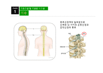 척수손상 및 외상성 뇌손상 -4