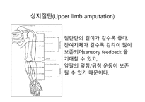 절단 환자와 의지의 관리 -6