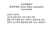 절단 환자와 의지의 관리 -10
