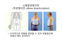 절단 환자와 의지의 관리 -11