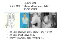 절단 환자와 의지의 관리 -12