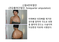 절단 환자와 의지의 관리 -14