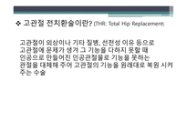 고관절 전치환술  환자의 일상생활활동 -4