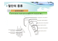 절단 환자와 의지의 관리 -6