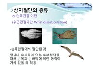 절단 환자와 의지의 관리 -8