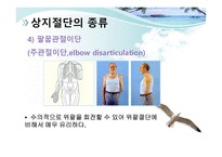 절단 환자와 의지의 관리 -10