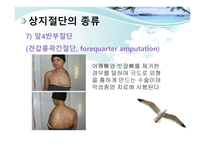 절단 환자와 의지의 관리 -13