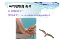 절단 환자와 의지의 관리 -16