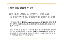 류마티스 관절염 (Rheumatoid Arthritis) -4