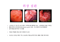 대체의학 위장질환 -1