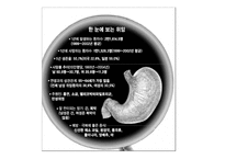 대체의학 위장질환 -4