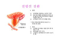 대체의학 위장질환 -12