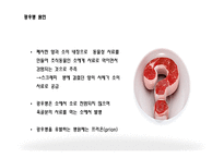 광우병의 정의, 원인, 증상   -4