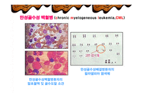 만성질환자 사례연구 (만성골수성 백혈병) -4