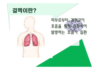 전염병이란, 전염 경로, 전염의 종류 -6