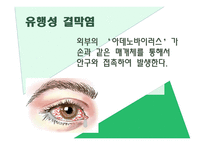 전염병이란, 전염 경로, 전염의 종류 -14