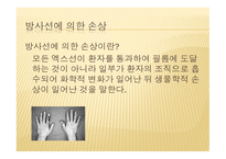 방사선 생물학, 방사선에 의한 손상을 설명하는 이론    -4