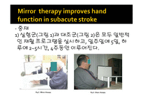 Mirror therapy improves hand function in subacute stroke A randomized controlled trial -9