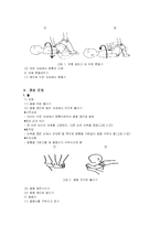 [정신건강]뇌성마비의 작업치료-2