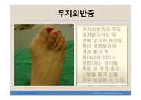 건강한 발을 위한 방법-4