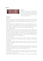주근깨와 기미-2