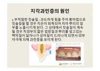 지각과민증 보고서-6