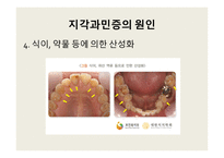 지각과민증 보고서-9