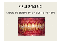 지각과민증 보고서-12