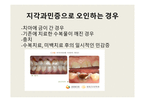 지각과민증 보고서-16