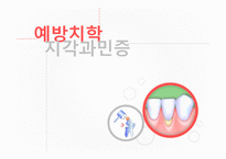 예방치학 지각과민증-1