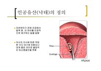 인공유산의 윤리문제-3