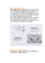 안면골 골절 보고서-19