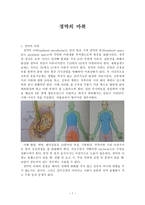 경막외 마취-1