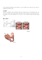 임상사례연구보고서 장폐색 intestinalobstruction-4