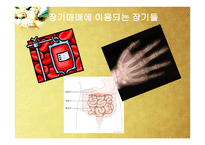 장기이식과 장기매매-12