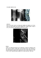 경추의 이해-4