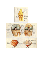 슬관절의 상해 Kneeinjury-5