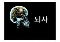 뇌사의 이해-1