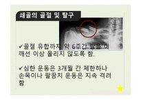 신체부위별 골절-4