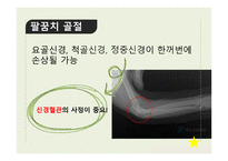 신체부위별 골절-6