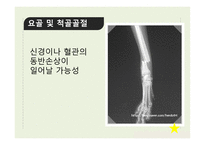 신체부위별 골절-7
