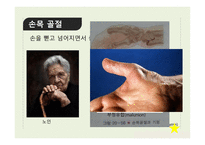 신체부위별 골절-8