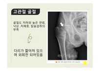 신체부위별 골절-13