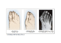 20대 질병-8