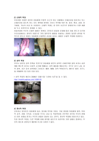 아동학대 개념, 유형, 발생원인 -4