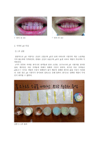 치약의 종류에 따른 치아 살균 효과 및 pH측정 -16