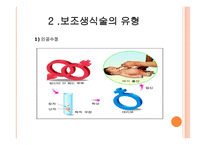 보조생식술을 통한 부모역할 - 1 보조생식술의 정의 2 보조생식술의 유형 -4