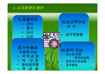 시각장애 (원인과 정의) -8