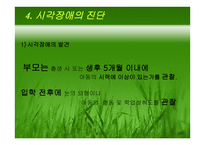시각장애 (원인과 정의) -10