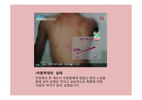 PPT-아동학대 -10